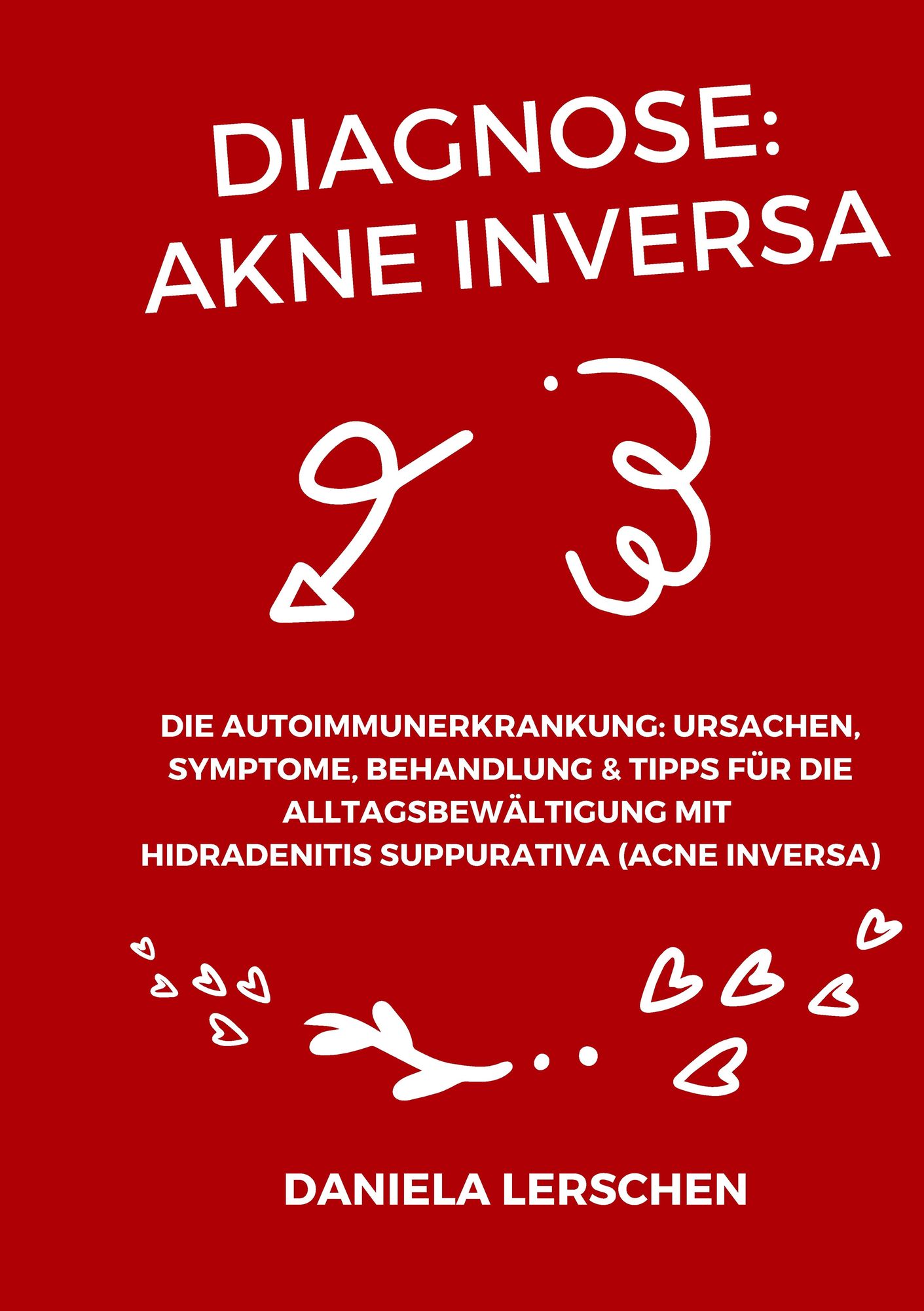 e-zigarette akne inversa Die stille Last der Acne inversa main image 0