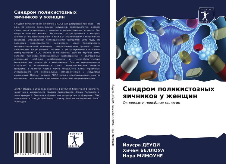Produktbild: Sindrom polikistoznyh qichnikow u zhenschin