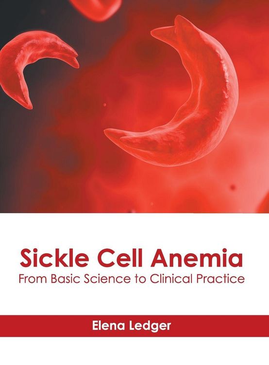Produktbild: Sickle Cell Anemia: From Basic Science to Clinical Practice
