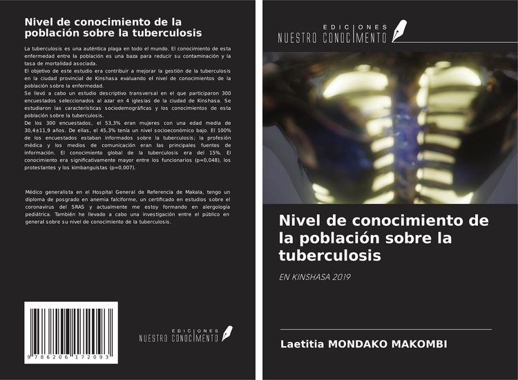 Produktbild: Nivel de conocimiento de la poblaci&oacute;n sobre la tuberculosis