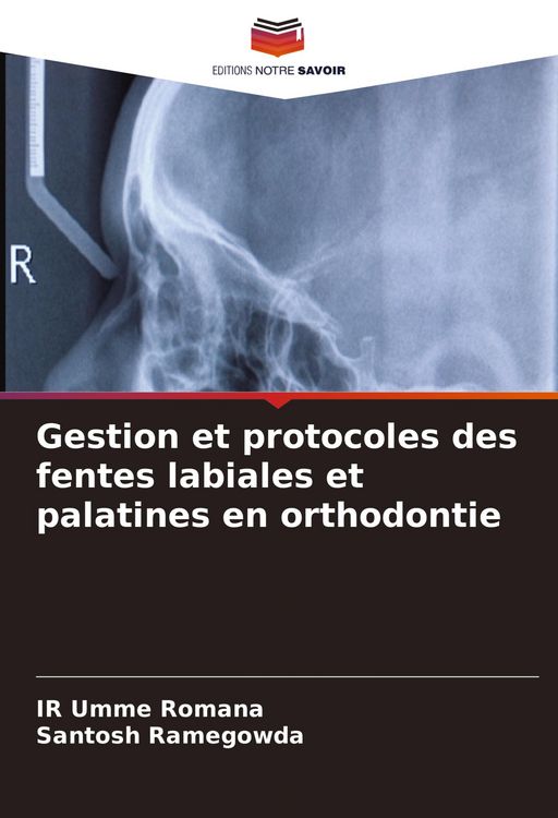 Produktbild: Gestion et protocoles des fentes labiales et palatines en orthodontie