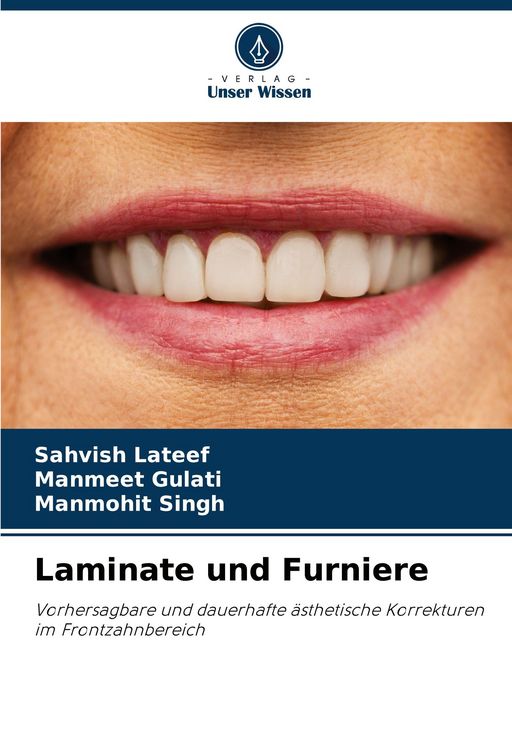 Produktbild: Laminate und Furniere