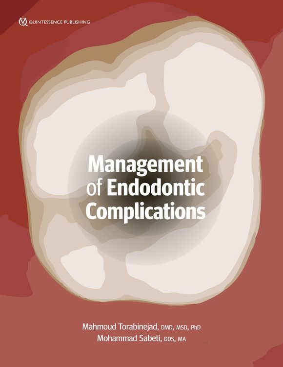 Produktbild: Management of Endodontic Complications
