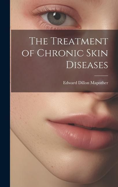 Produktbild: The Treatment of Chronic Skin Diseases