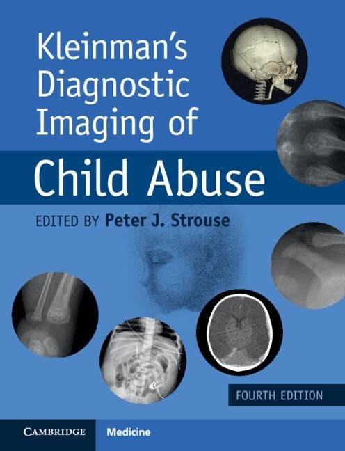 Produktbild: Kleinman's Diagnostic Imaging of Child Abuse
