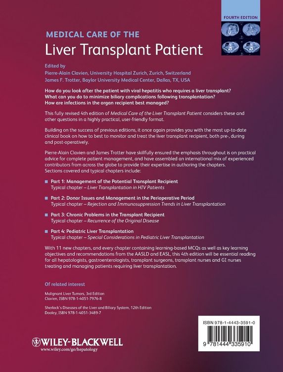 Produktbild: Medical Care of the Liver Transplant Patient