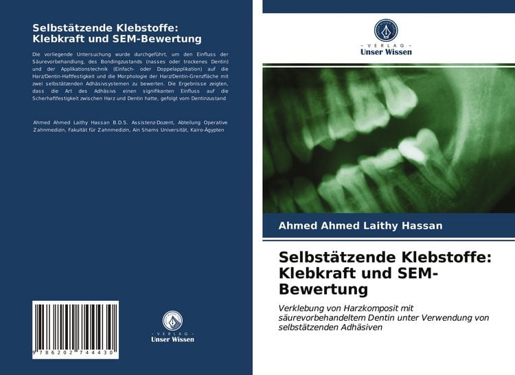 Produktbild: Selbst&auml;tzende Klebstoffe: Klebkraft und SEM-Bewertung