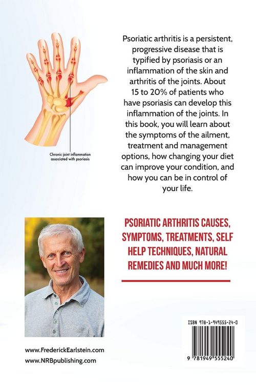 Produktbild: Psoriatic Arthritis Explained