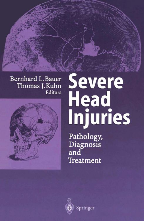 Produktbild: Severe Head Injuries