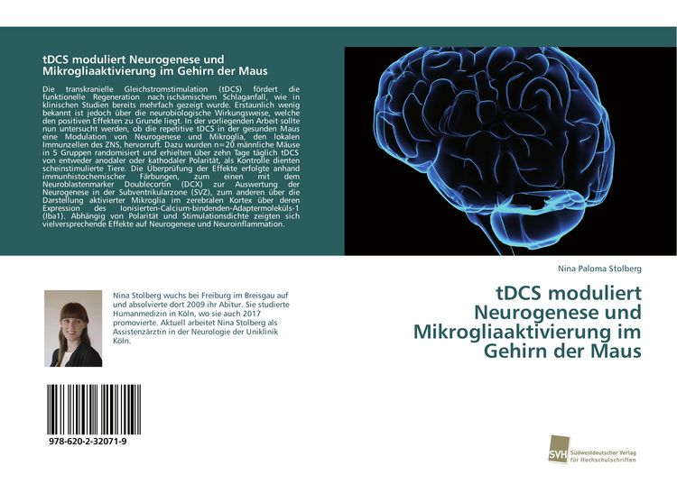 Produktbild: TDCS moduliert Neurogenese und Mikrogliaaktivierung im Gehirn der Maus