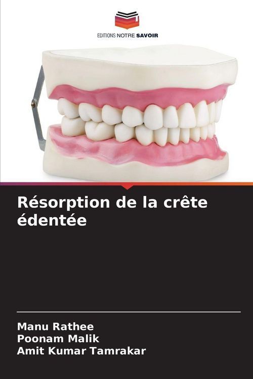 Produktbild: R&eacute;sorption de la cr&ecirc;te &eacute;dent&eacute;e