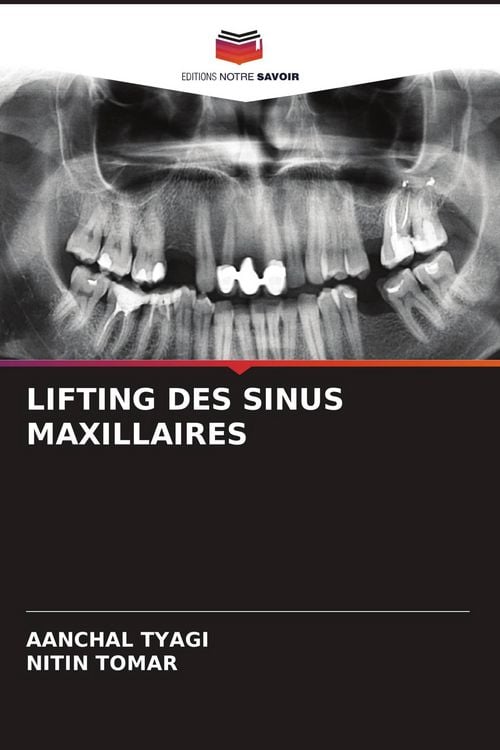 Produktbild: Lifting des Sinus Maxillaires