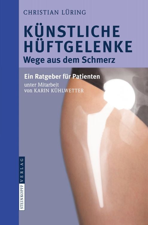 Produktbild: K&uuml;nstliche H&uuml;ftgelenke