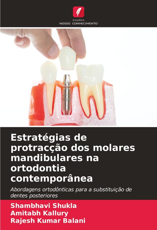 Produktbild: Estrat&eacute;gias de protrac&ccedil;&atilde;o dos molares mandibulares na ortodontia contempor&acirc;nea