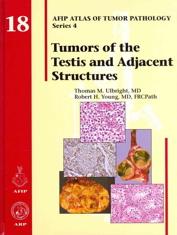 Produktbild: Thomas M. Ulbright: Tumors of the Testis and Adjacent Struc