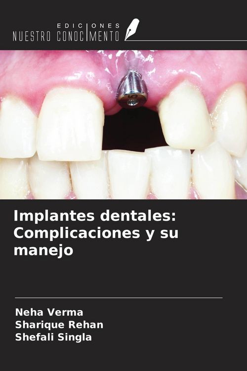 Produktbild: Implantes dentales: Complicaciones y su manejo