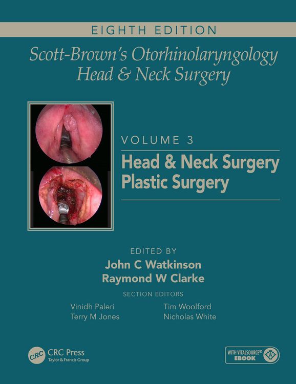 Produktbild: Scott-Brown's Otorhinolaryngology and Head and Neck Surgery
