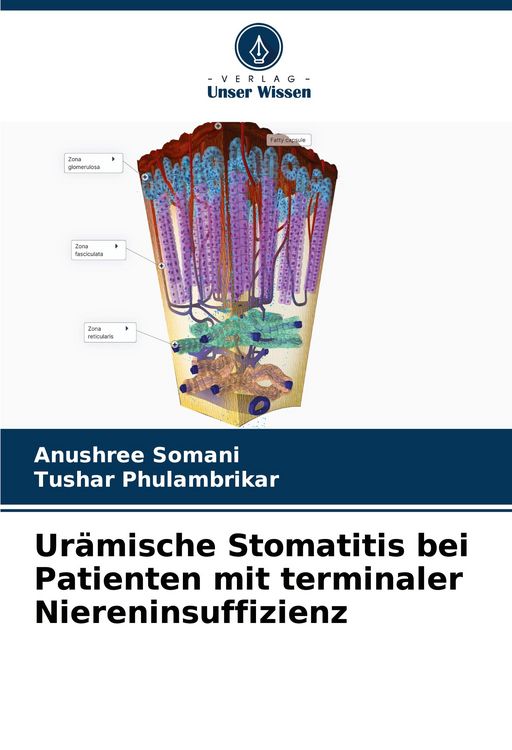 Produktbild: Ur&auml;mische Stomatitis bei Patienten mit terminaler Niereninsuffizienz
