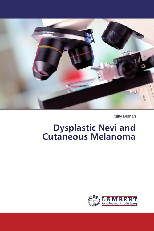 Produktbild: Dysplastic Nevi and Cutaneous Melanoma