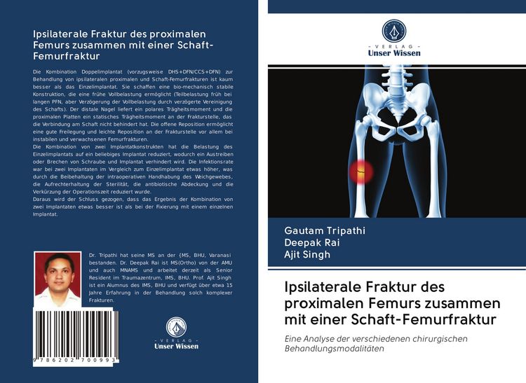 Produktbild: Ipsilaterale Fraktur des proximalen Femurs zusammen mit einer Schaft-Femurfraktur