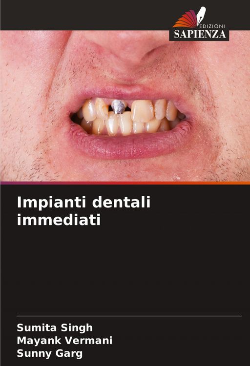 Produktbild: Impianti dentali immediati