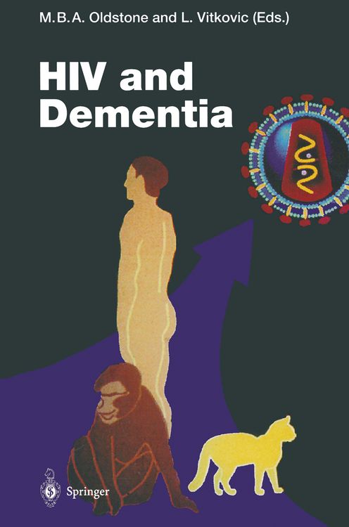 Produktbild: HIV and Dementia