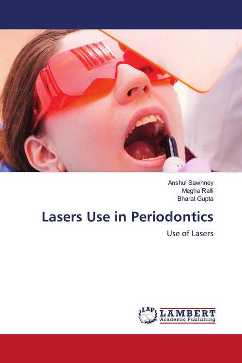 Produktbild: Lasers Use in Periodontics