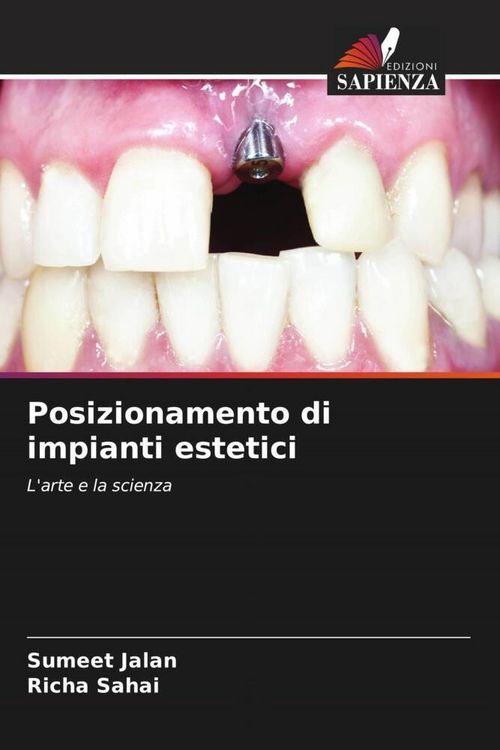 Produktbild: Posizionamento di impianti estetici