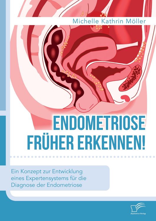 Produktbild: Endometriose fr&uuml;her erkennen! Ein Konzept zur Entwicklung eines Expertensystems f&uuml;r die Diagnose der Endometriose