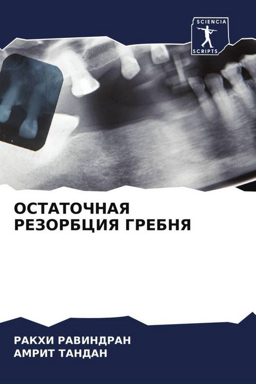 Produktbild: Ostatochnaya Rezorbciya Grebnya