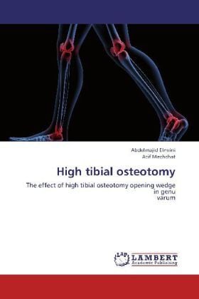Produktbild: Elmrini, A: High tibial osteotomy