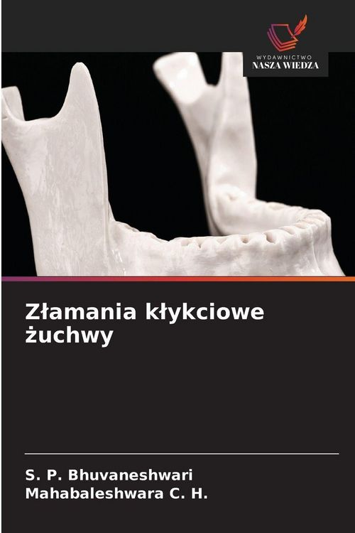 Produktbild: Z&iquest;amania k&iquest;ykciowe &iquest;uchwy