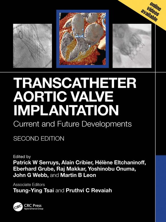 Produktbild: Transcatheter Aortic Valve Implantation