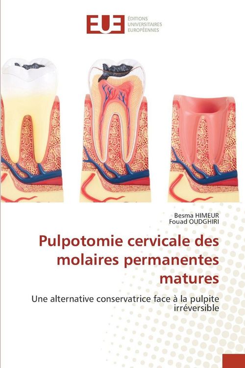Produktbild: Pulpotomie cervicale des molaires permanentes matures