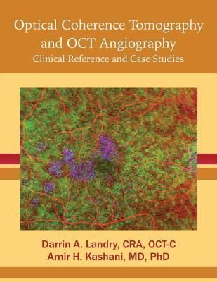 Produktbild: Optical Coherence Tomography and OCT Angiography: Clinical Reference and Case Studies