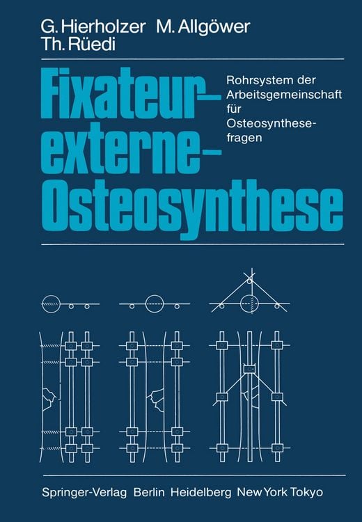 Produktbild: Fixateur-externe-Osteosynthese