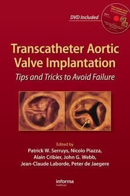 Produktbild: Transcatheter Aortic Valve Implantation