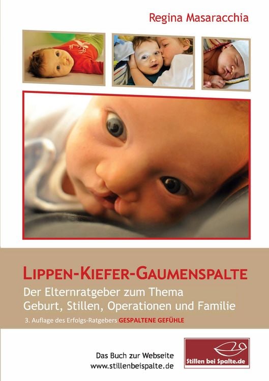 Produktbild: Lippen-Kiefer-Gaumenspalte