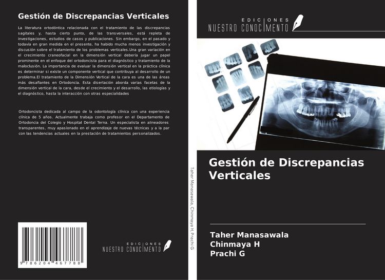 Produktbild: Gesti&oacute;n de Discrepancias Verticales