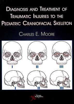 Produktbild: Diagnosis and Treatment of Traumatic Injuries to the Pediatric Craniofacial Skeleton