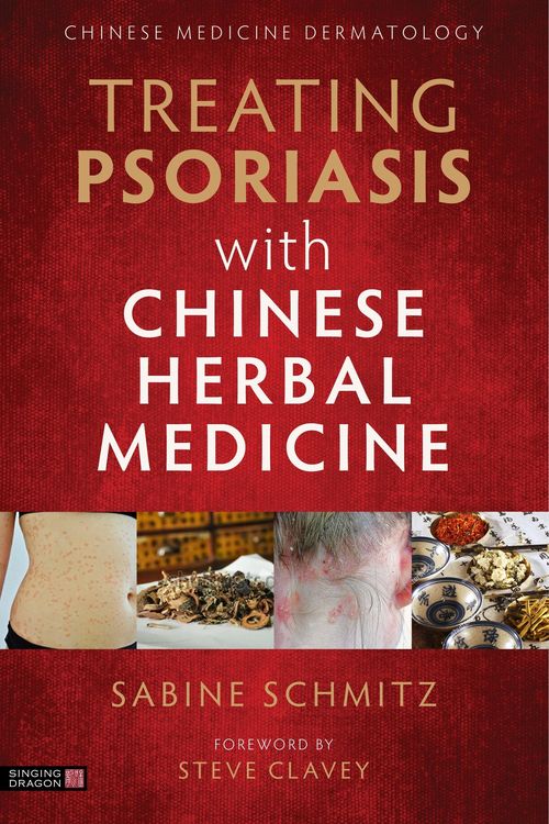Produktbild: Treating Psoriasis with Chinese Herbal Medicine (Revised Edition)