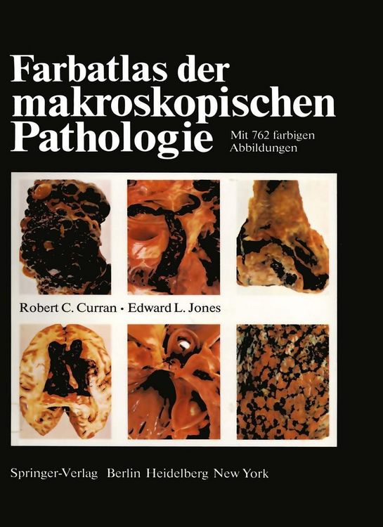 Produktbild: Farbatlas der makroskopischen Pathologie