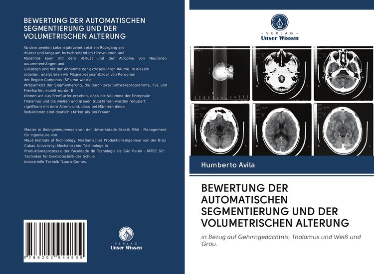 Produktbild: Bewertung der Automatischen Segmentierung und der Volumetrischen Alterung