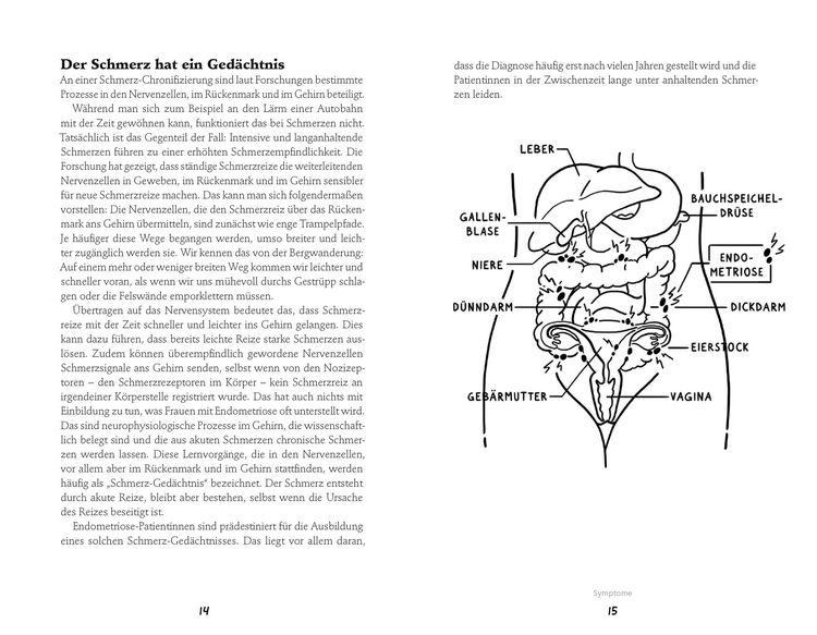Produktbild: Endometriose-Sprechstunde
