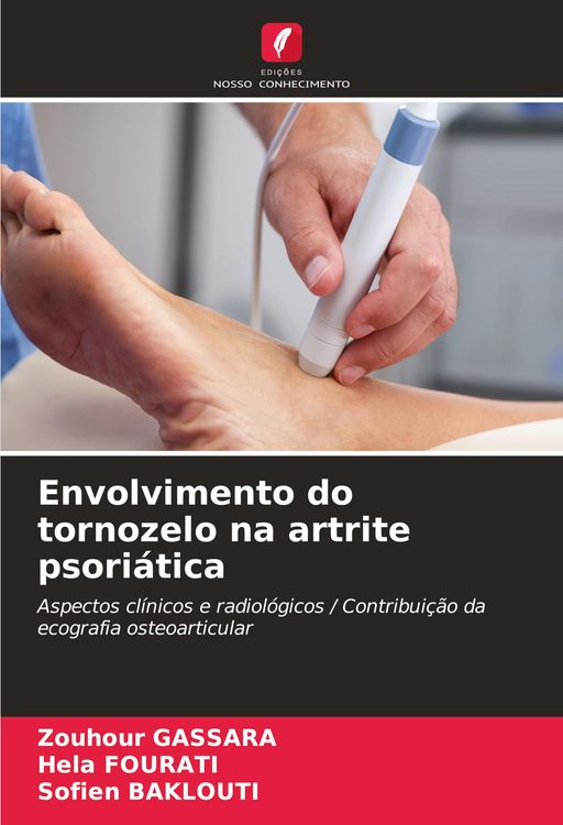 Produktbild: Envolvimento do tornozelo na artrite psori&aacute;tica