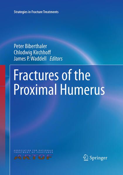 Produktbild: Fractures of the Proximal Humerus