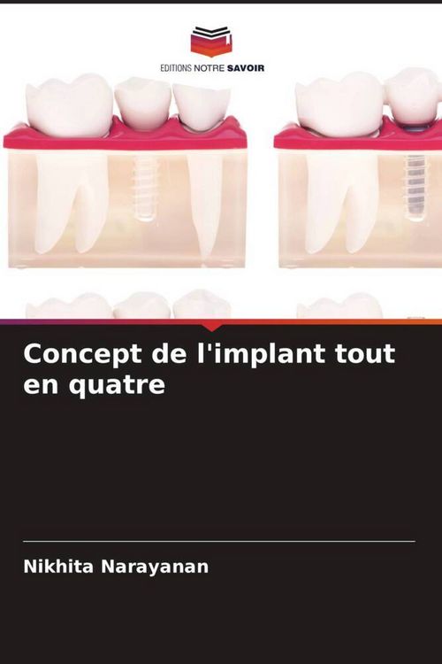 Produktbild: Concept de l'implant tout en quatre