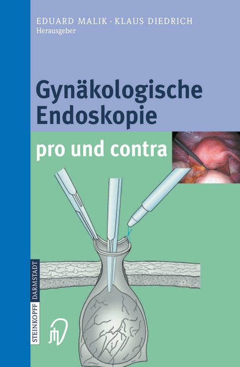 Produktbild: Gyn&auml;kologische Endoskopie pro und contra