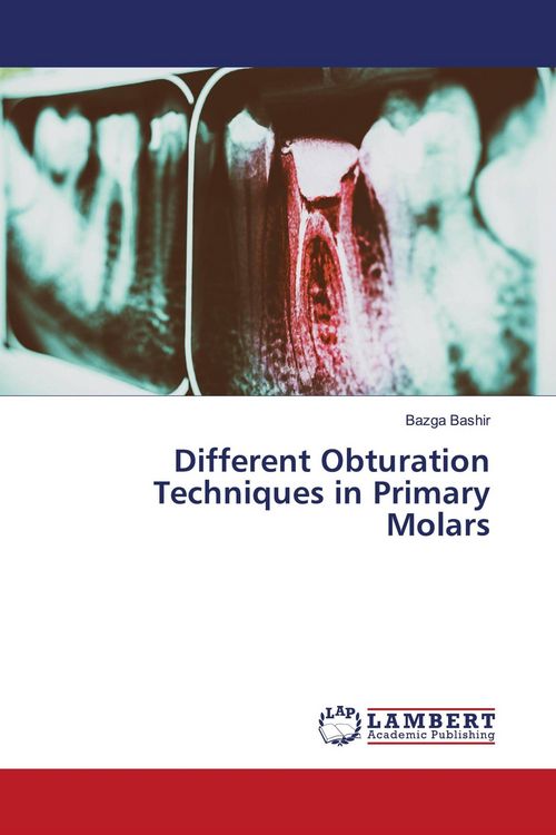 Produktbild: Different Obturation Techniques in Primary Molars