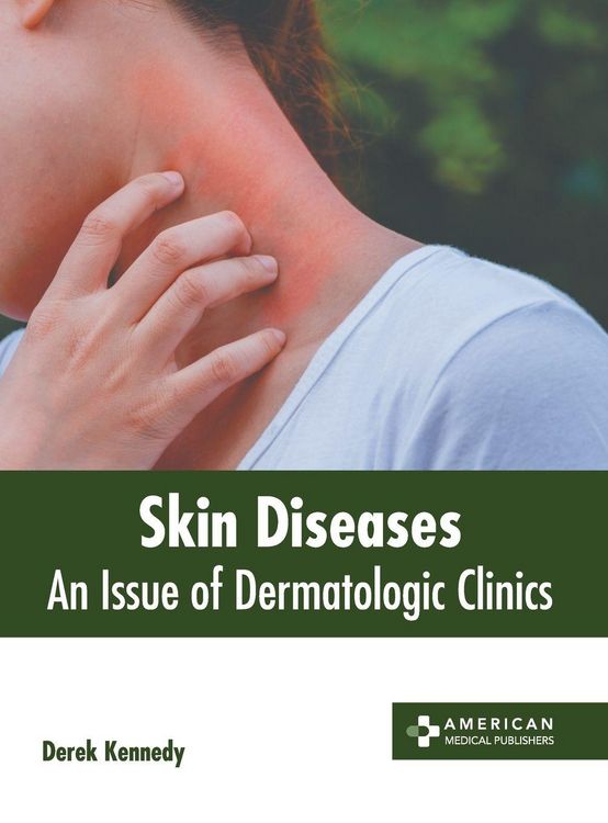 Produktbild: Skin Diseases: An Issue of Dermatologic Clinics